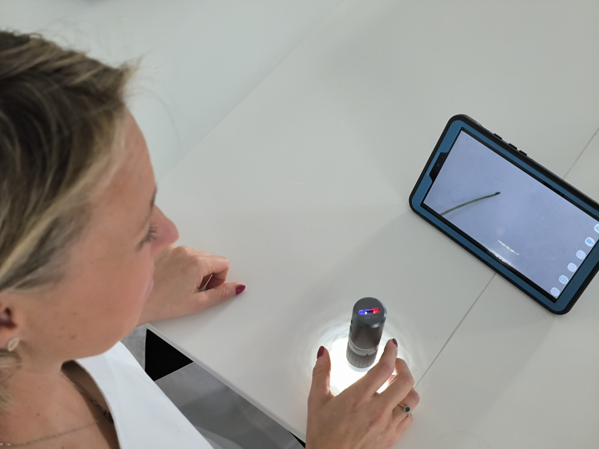 Analisi di pelle e pelo al dermatoscopio prima dell’epilazione laser